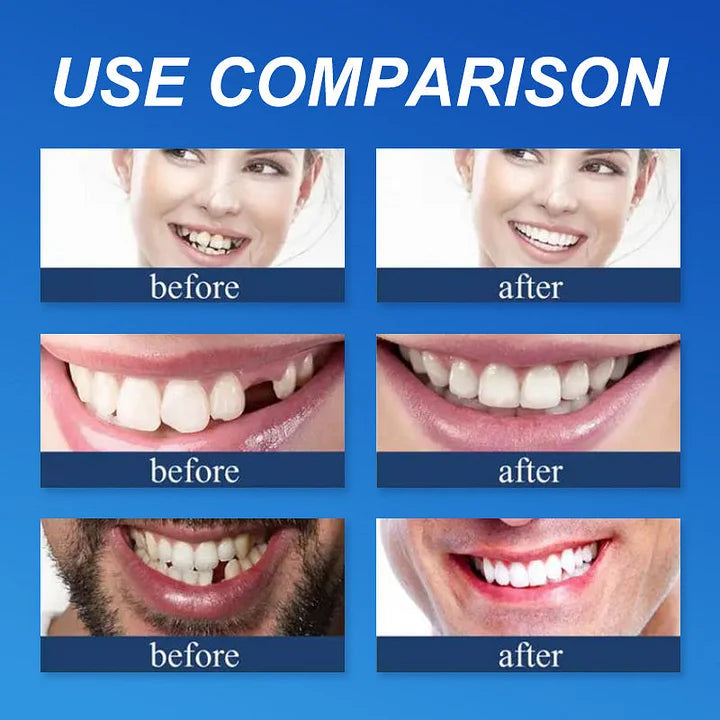 🔥🔥Ends Today: 75% OFF!🦷 DarkFairy™ Custom-Fit Denture
