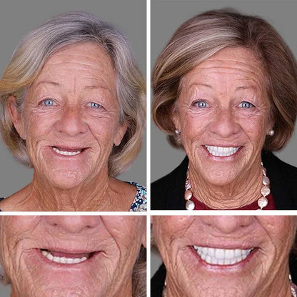 🔥🔥Ends Today: 75% OFF!🦷 DarkFairy™ Custom-Fit Denture